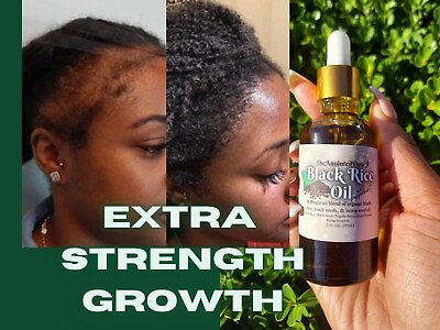 Organic Black Rice Oil for FAST Growth Dry Scalp Rice Peppermint Black Seed