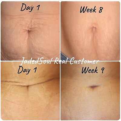 Compared to B Flat Firming Belly Cellulite Reduce anti aging Cream